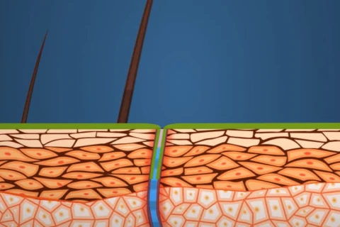 explication antitranspirant extiaxil